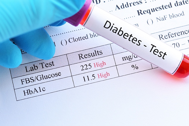A-Comprehensive-Review-of-Diabetes-Test